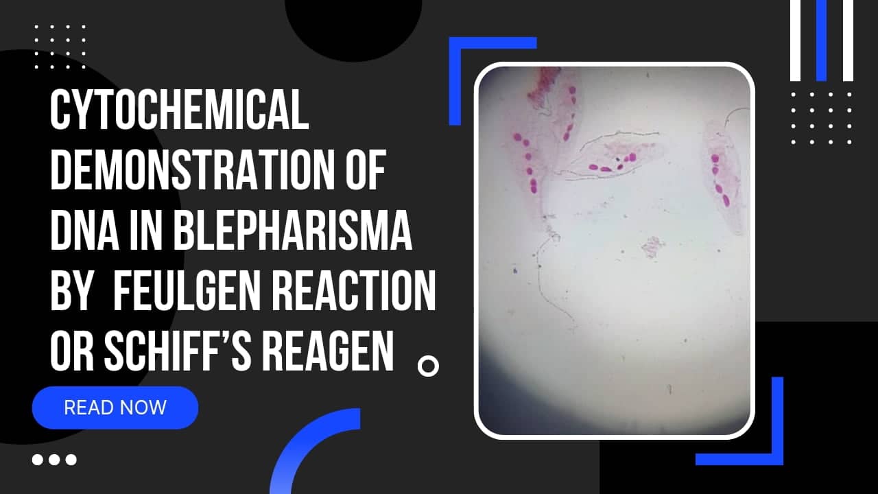CYTOCHEMICAL DEMONSTRATION OF DNA IN BLEPHARISMA BY  FEULGEN REACTION OR SCHIFF’S REAGENT