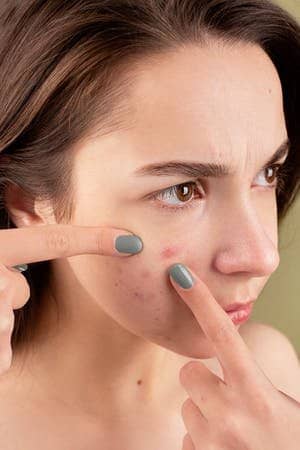 15 Amazing Benefits Of Guava Oil For Skin