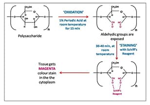 CYTOCHEMICAL DEMONSTRATION OF MUCOPOLYSACCHARIDE IN
BLEPHARISMA BY PERIODIC ACID SCHIFF (PAS) REACTION.