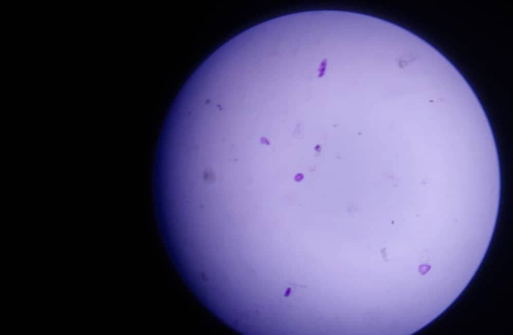 Unstained Nucleus