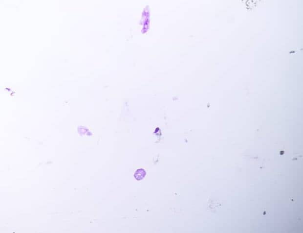 CYTOCHEMICAL DEMONSTRATION OF MUCOPOLYSACCHARIDE IN BLEPHARISMA BY PERIODIC ACID SCHIFF (PAS) REACTION.
