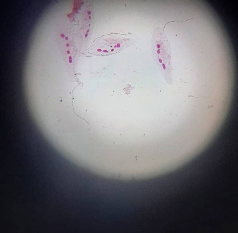 CYTOCHEMICAL DEMONSTRATION OF DNA IN BLEPHARISMA BY FEULGEN REACTION OR SCHIFF’S REAGENT
