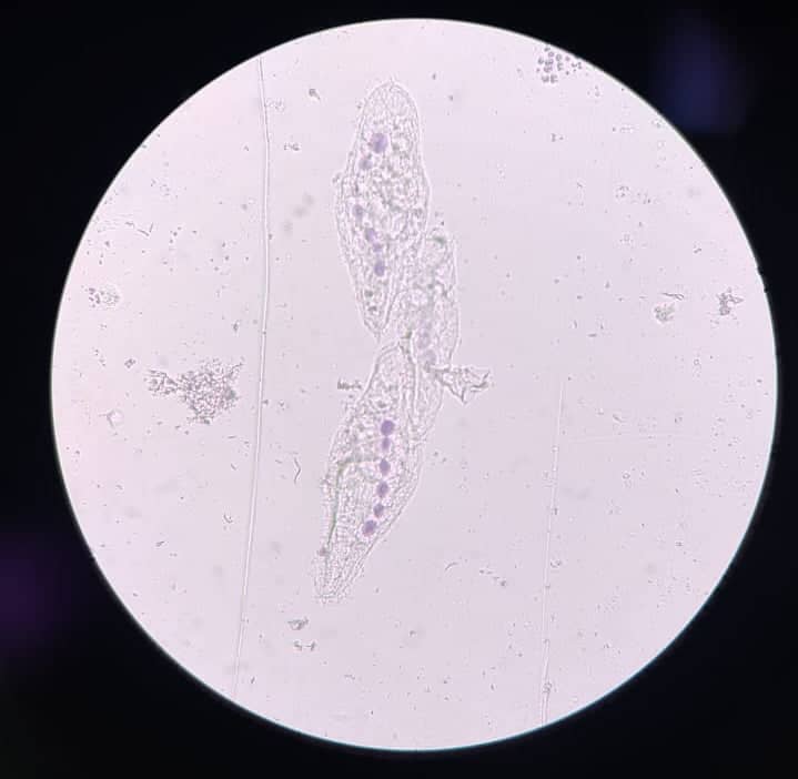 CYTOCHEMICAL DEMONSTRATION OF DNA IN BLEPHARISMA BY FEULGEN REACTION OR SCHIFF’S REAGENT